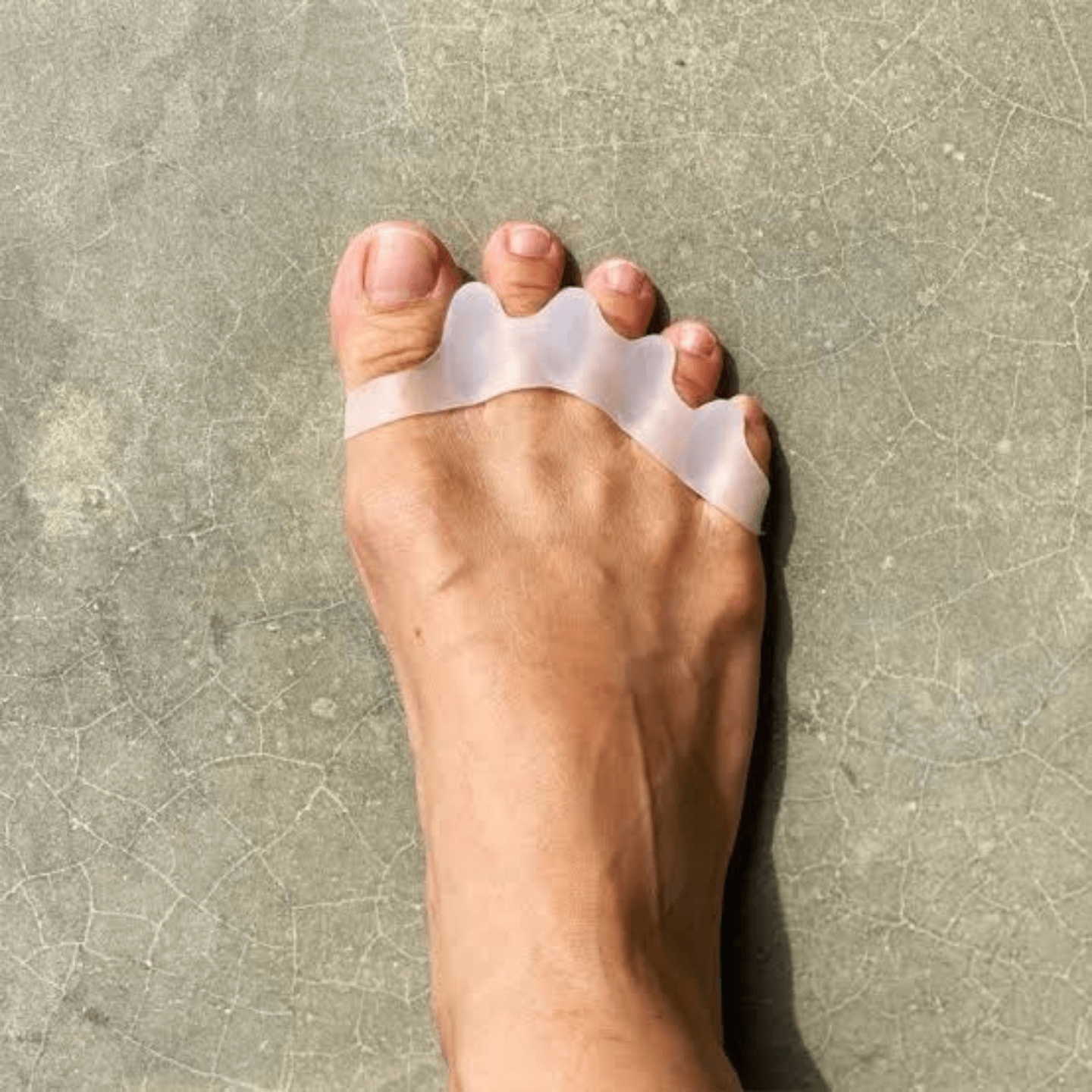 Active Recovery Toe Spacing Kit